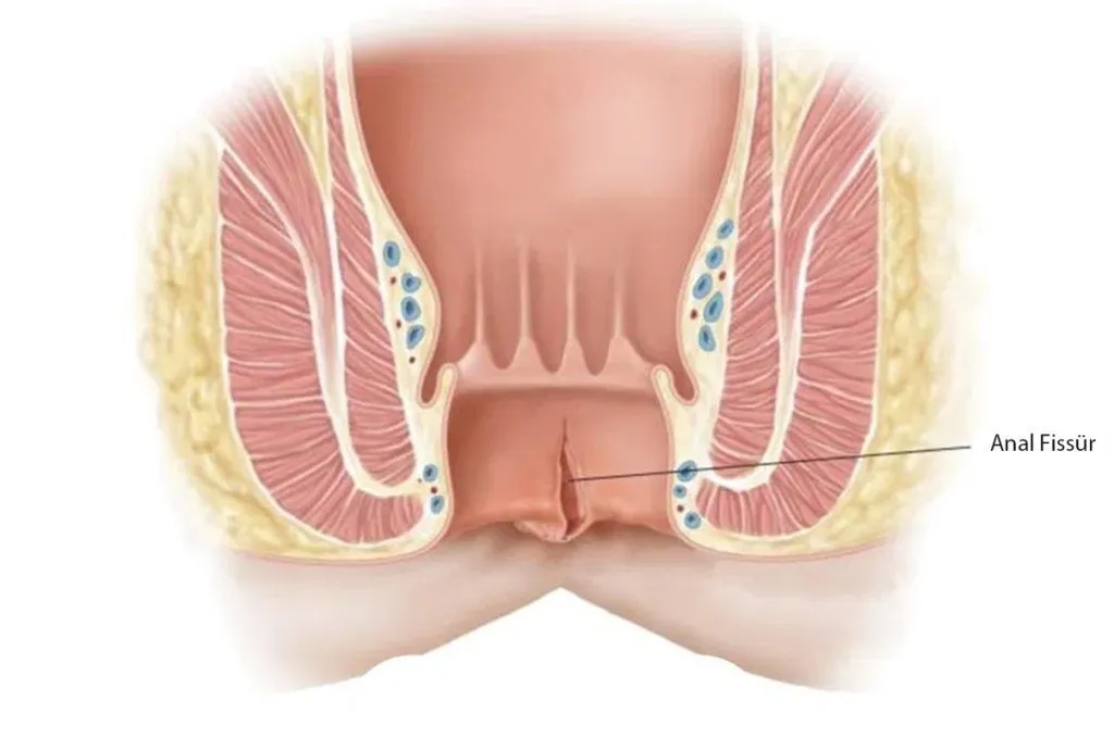 Frederik Lamont porno video